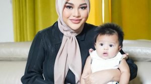 Ameena Anak Atta dan Aurel Idap Penyakit Kulit