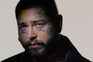 Post Malone Dilarikan ke Rumah Sakit, Konser di Boston Batal