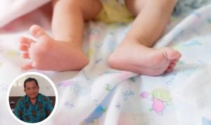 Foto: Ilustrasi bayi stunting (Sumber: iStock)