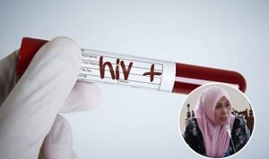 Foto: Ilustrasi HIV (Sumber: iStock)