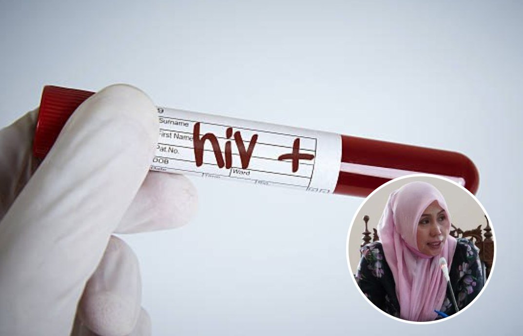 Foto: Ilustrasi HIV (Sumber: iStock)